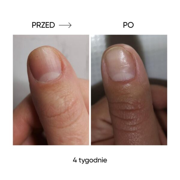 NAILSOFTHEDAY ONISTOP Regenerating Oil 8ml