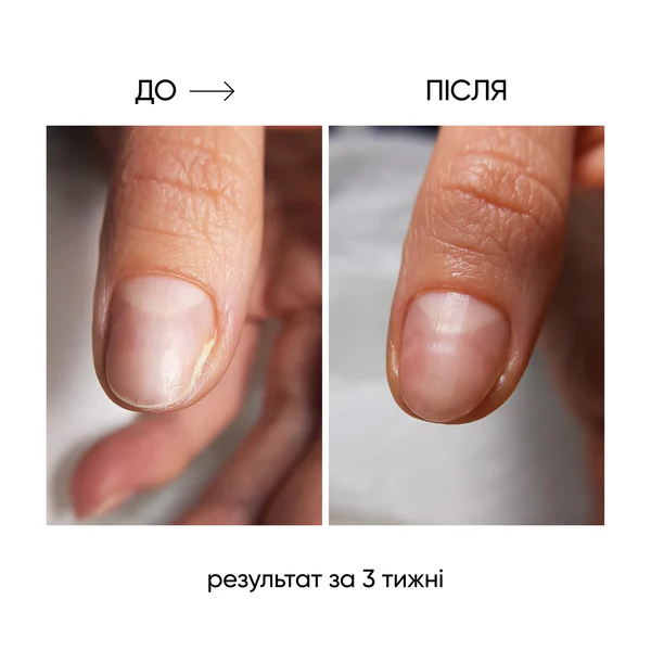 NAILSOFTHEDAY ONISTOP Regenerating Oil 8ml